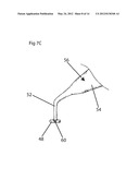 Tissue Desensitization Instrument & Method diagram and image