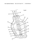 Tissue Desensitization Instrument & Method diagram and image