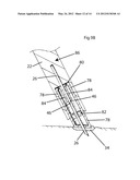 Tissue Desensitization Instrument & Method diagram and image