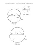 NEUROMODULATION CRYOTHERAPEUTIC DEVICES AND ASSOCIATED SYSTEMS AND METHODS diagram and image