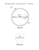 NEUROMODULATION CRYOTHERAPEUTIC DEVICES AND ASSOCIATED SYSTEMS AND METHODS diagram and image