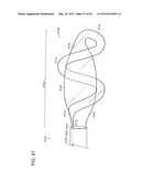 NEUROMODULATION CRYOTHERAPEUTIC DEVICES AND ASSOCIATED SYSTEMS AND METHODS diagram and image