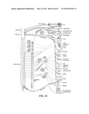 NEUROMODULATION CRYOTHERAPEUTIC DEVICES AND ASSOCIATED SYSTEMS AND METHODS diagram and image