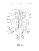 NEUROMODULATION CRYOTHERAPEUTIC DEVICES AND ASSOCIATED SYSTEMS AND METHODS diagram and image