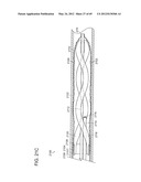 NEUROMODULATION CRYOTHERAPEUTIC DEVICES AND ASSOCIATED SYSTEMS AND METHODS diagram and image