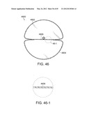 NEUROMODULATION CRYOTHERAPEUTIC DEVICES AND ASSOCIATED SYSTEMS AND METHODS diagram and image