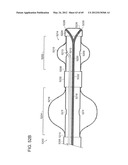 NEUROMODULATION CRYOTHERAPEUTIC DEVICES AND ASSOCIATED SYSTEMS AND METHODS diagram and image