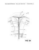 ENDOMETRIAL ABLATION DEVICES AND SYSTEMS diagram and image