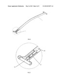 STEEL PLATE FOR FUNNEL CHEST ORTHOPAEDIC SURGERY diagram and image