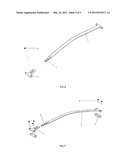 STEEL PLATE FOR FUNNEL CHEST ORTHOPAEDIC SURGERY diagram and image