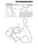 BONE FIXING SYSTEM diagram and image