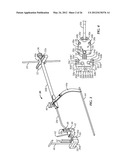 SURGICAL INSTRUMENTATION AND METHODS OF USE FOR IMPLANTING A PROSTHESIS diagram and image