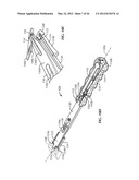 SURGICAL INSTRUMENTATION AND METHODS OF USE FOR IMPLANTING A PROSTHESIS diagram and image