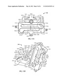 SURGICAL INSTRUMENTATION AND METHODS OF USE FOR IMPLANTING A PROSTHESIS diagram and image