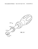 SURGICAL INSTRUMENTATION AND METHODS OF USE FOR IMPLANTING A PROSTHESIS diagram and image