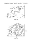 SURGICAL INSTRUMENTATION AND METHODS OF USE FOR IMPLANTING A PROSTHESIS diagram and image