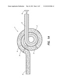 BONE GRAFT INJECTION SYRINGE diagram and image