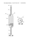 BONE GRAFT INJECTION SYRINGE diagram and image