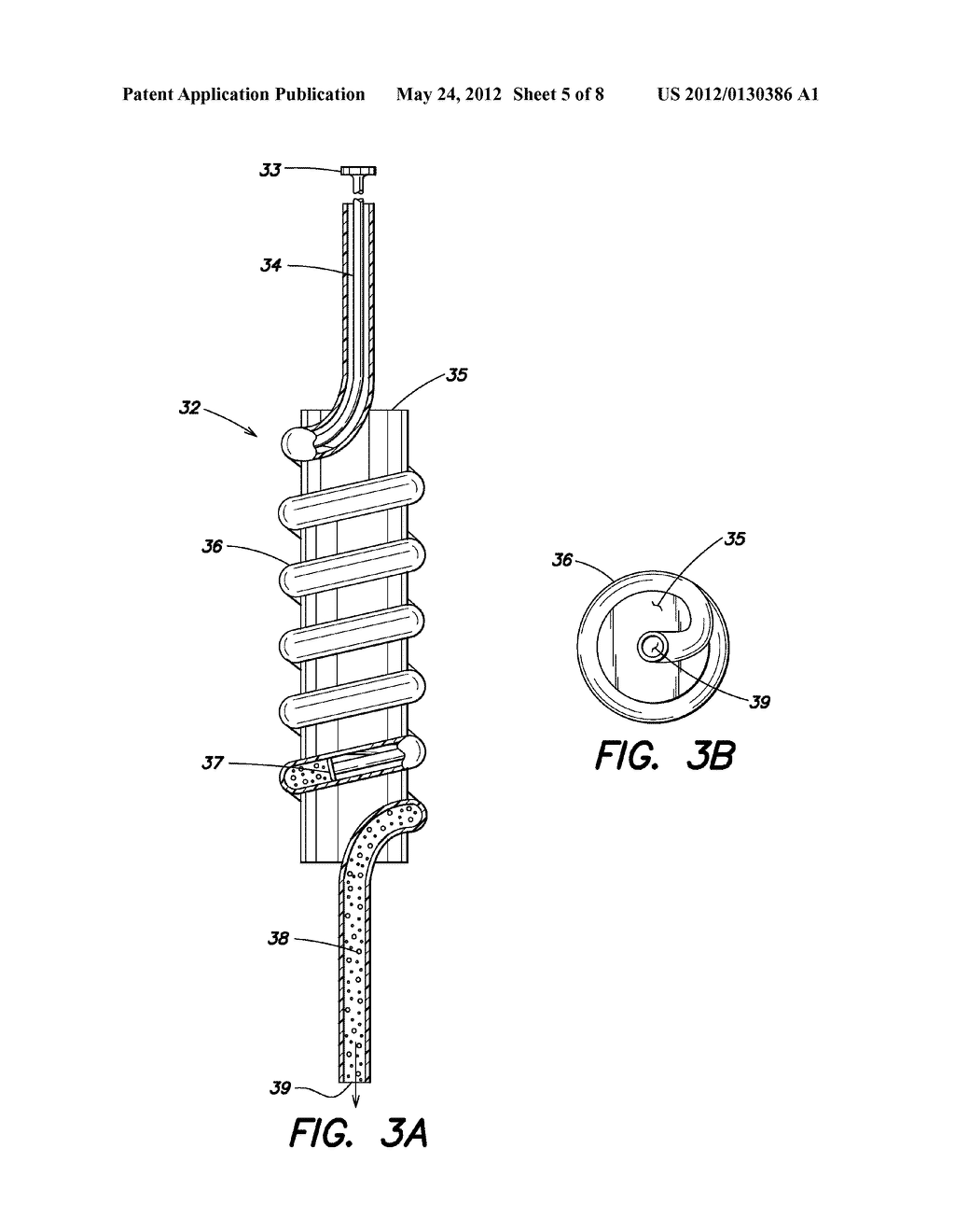 BONE GRAFT INJECTION SYRINGE - diagram, schematic, and image 06