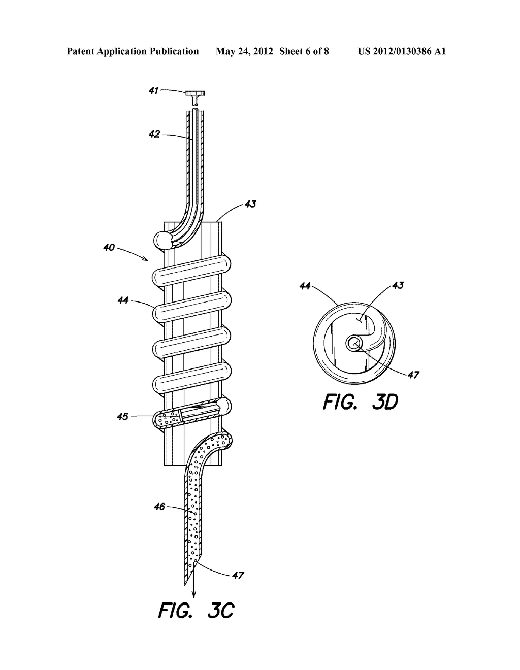 BONE GRAFT INJECTION SYRINGE - diagram, schematic, and image 07