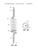 BONE GRAFT INJECTION SYRINGE diagram and image