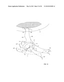 APPARATUS AND METHOD FOR PERFORMING OCULAR SURGERY diagram and image