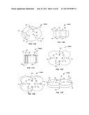 APPARATUS AND METHOD FOR PERFORMING OCULAR SURGERY diagram and image