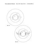 APPARATUS AND METHOD FOR PERFORMING OCULAR SURGERY diagram and image