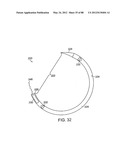 APPARATUS AND METHOD FOR MINIMALLY INVASIVE SUTURING diagram and image