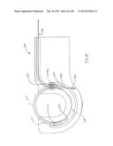 APPARATUS AND METHOD FOR MINIMALLY INVASIVE SUTURING diagram and image