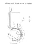 APPARATUS AND METHOD FOR MINIMALLY INVASIVE SUTURING diagram and image