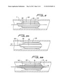 CUTTING WIRE ASSEMBLY FOR USE WITH A CATHETER diagram and image