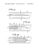 CUTTING WIRE ASSEMBLY FOR USE WITH A CATHETER diagram and image