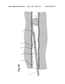 SURGICAL CUTTING INSTRUMENT diagram and image