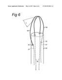 SURGICAL CUTTING INSTRUMENT diagram and image