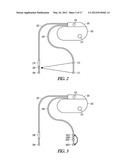 CARDIAC ANODAL ELECTROSTIMULATION DETECTION diagram and image