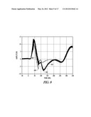 CARDIAC ANODAL ELECTROSTIMULATION DETECTION diagram and image