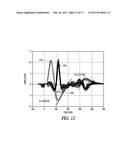 CARDIAC ANODAL ELECTROSTIMULATION DETECTION diagram and image