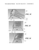 FOLDED ANTENNAS FOR IMPLANTABLE MEDICAL DEVICES diagram and image