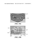 FOLDED ANTENNAS FOR IMPLANTABLE MEDICAL DEVICES diagram and image