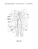 NEUROMODULATION CRYOTHERAPEUTIC DEVICES AND ASSOCIATED SYSTEMS AND METHODS diagram and image