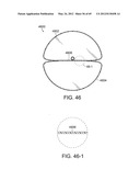 NEUROMODULATION CRYOTHERAPEUTIC DEVICES AND ASSOCIATED SYSTEMS AND METHODS diagram and image