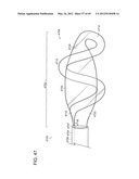 NEUROMODULATION CRYOTHERAPEUTIC DEVICES AND ASSOCIATED SYSTEMS AND METHODS diagram and image