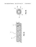 Implantable Lead Comprising an Elongate Lead Body diagram and image
