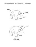 Punch, Implant and Associated Method diagram and image