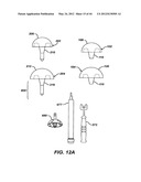 Punch, Implant and Associated Method diagram and image