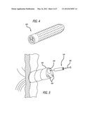 PERMANENT UMBILICAL HOLLOW TUBE diagram and image