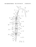 Spinal Protective Device diagram and image