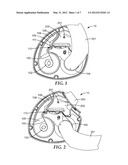 DRY POWDER INHALERS diagram and image