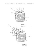 INHALER diagram and image